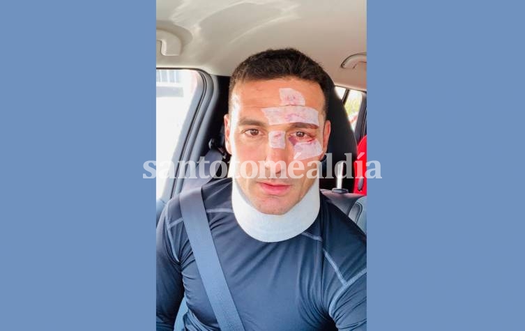 Scaloni sufrió un accidente vial en España