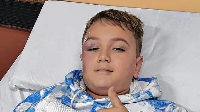 Atropellaron a un chico de 11 años en la ciclovía de Alem y Vélez Sarsfield: el conductor se fugó y la familia pide testigos
