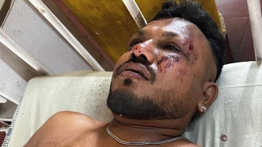 Milagro en medio del desastre: un hombre sobrevive al accidente del Boeing 787 en la India