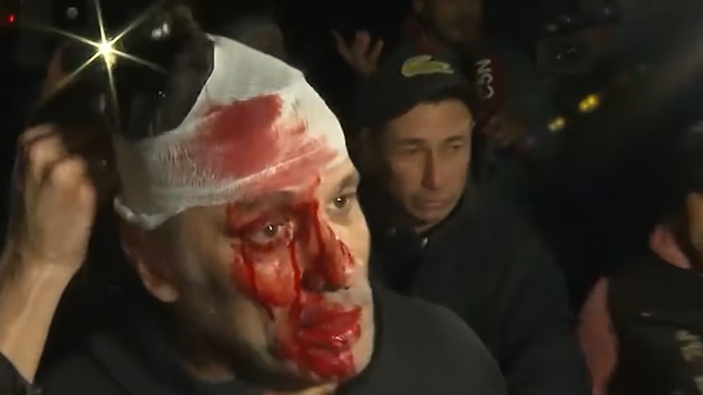 Graves incidentes en el acto de Javier Milei en Moreno