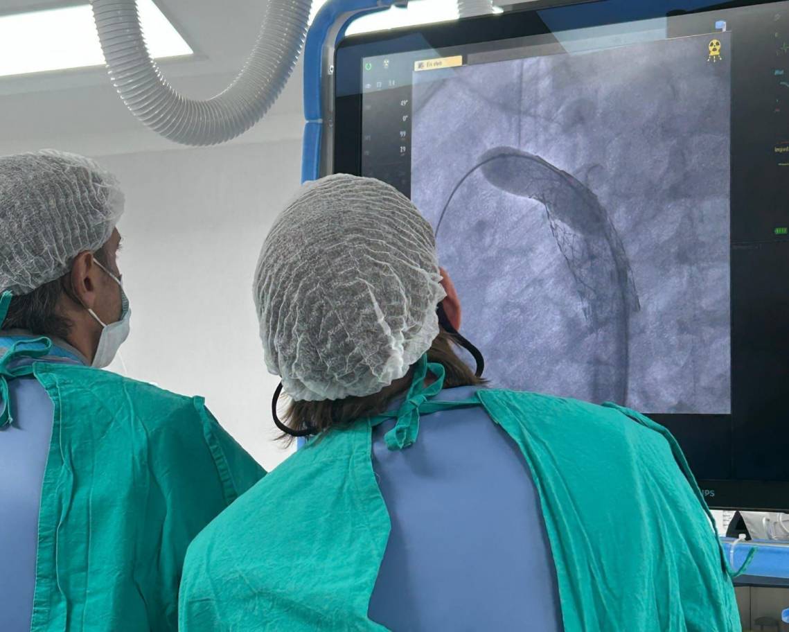 Cardiopatías congénitas: el Hospital Alassia concretó con éxito las dos primeras intervenciones con el nuevo angiógrafo